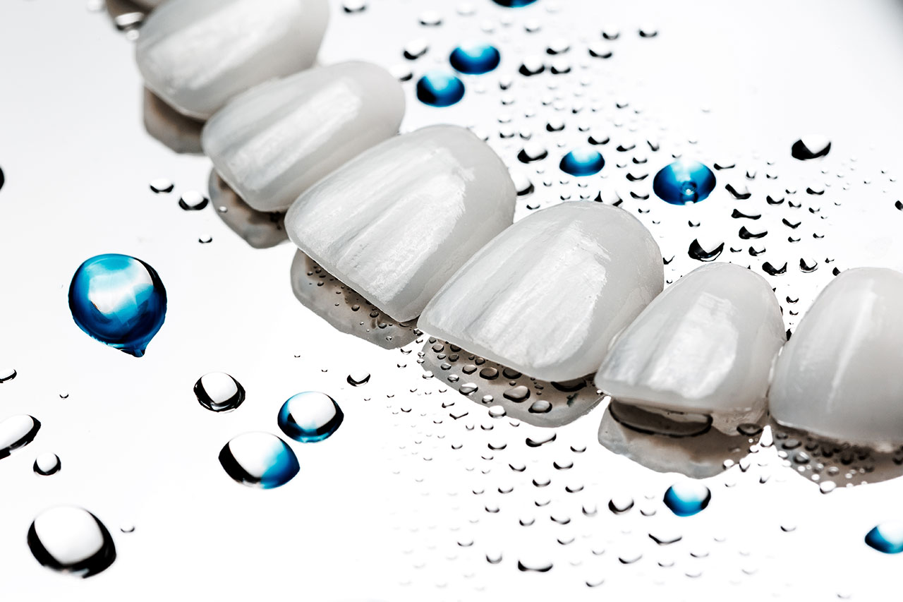 Porcelain Veneers in South Plainfield: Small Changes That Can Reshape a Smile
