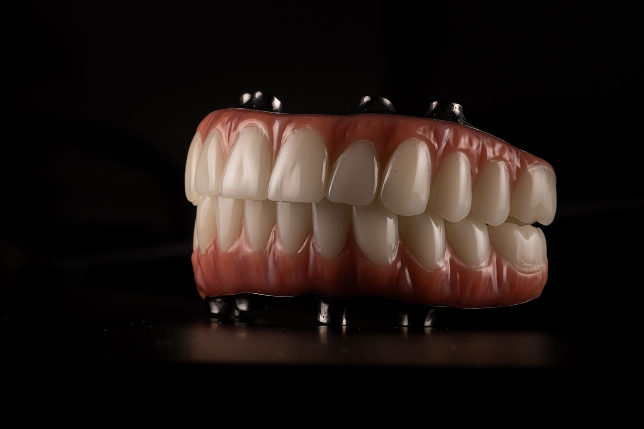 Snap-In Dentures in Denville: A More Secure Way to Restore Your Smile